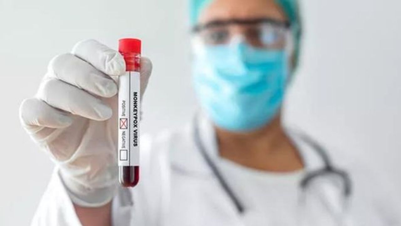 Nijerya'da maymun çiçeğinden ölenlerin sayısı arttı