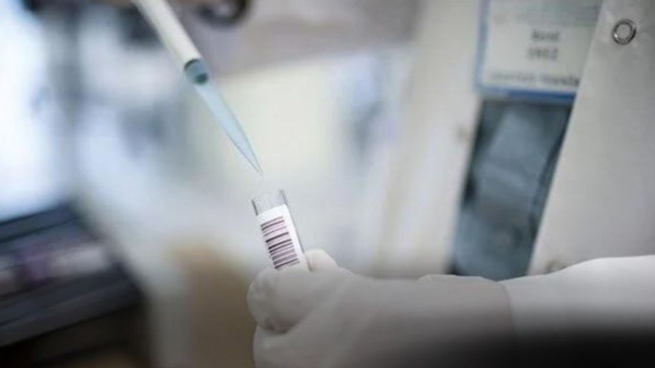 KKTC'de ilk maymun çiçeği vakası