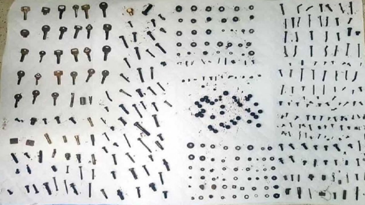 İran'da bir hastanın midesinden 450 parça metal çıkarıldı