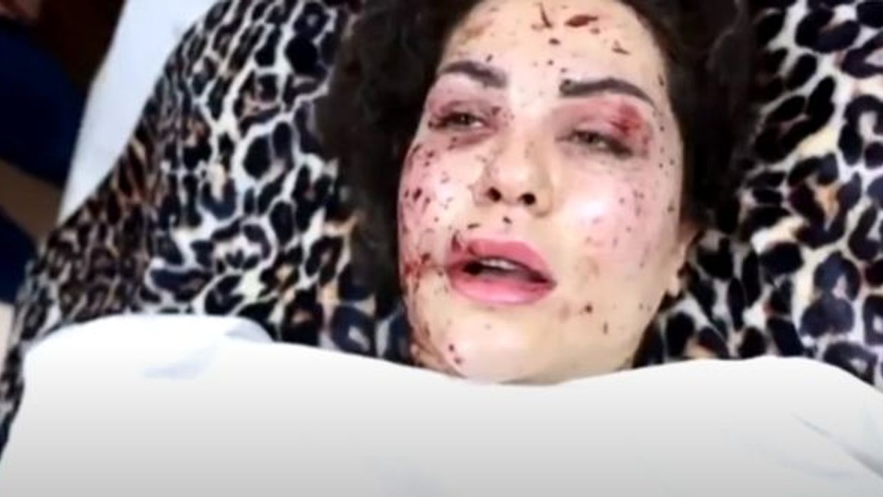 Dizayi'nin eşi saldırı anını anlattı