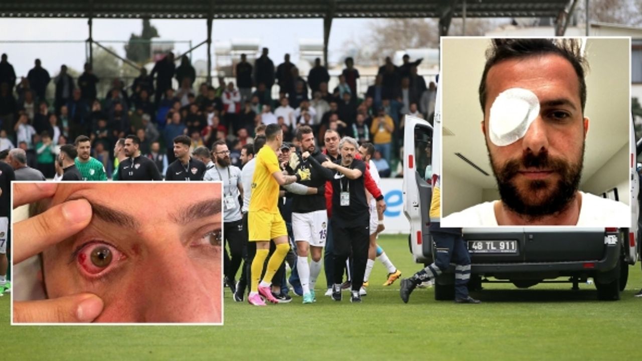 Maçta gözüne yabancı cisim çarpan futbolcunun retinası yırtıldı