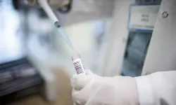 Sağlık Bakanlığından hemorajik ateş vakası açıklaması