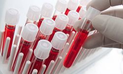 Hindistan’da Yeni Kan Grubu keşfedildi: “CRIB”