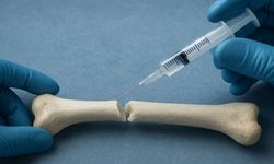 Çin’den çığır açan buluş: 3 dakikada kırıkları onaran kemik yapıştırıcısı