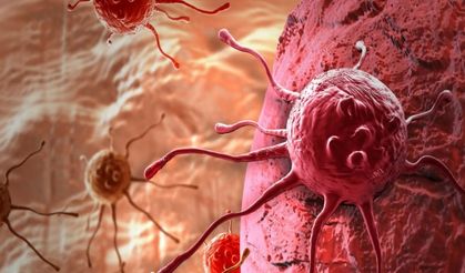 Araştırma: Metabolik sendromların kötüleşmesi, kanser riskini artırıyor