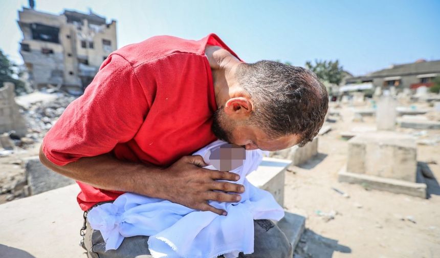 DSÖ: Gazze Şeridi'nde temmuzda yetersiz beslenme nedeniyle 63 kişi öldü